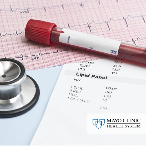 Lipid values in a lab report along with tube of blood