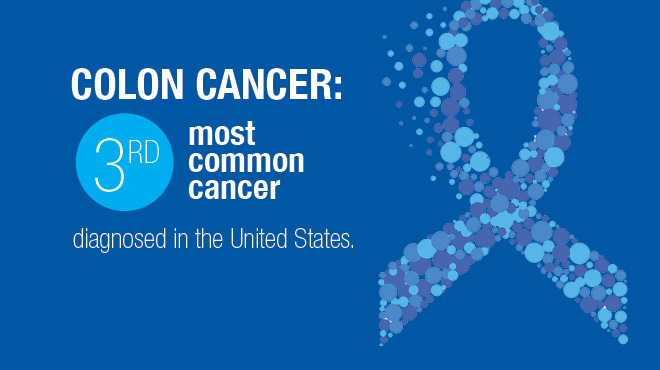 Colon cancer is the third most common cancer in the U.S.
