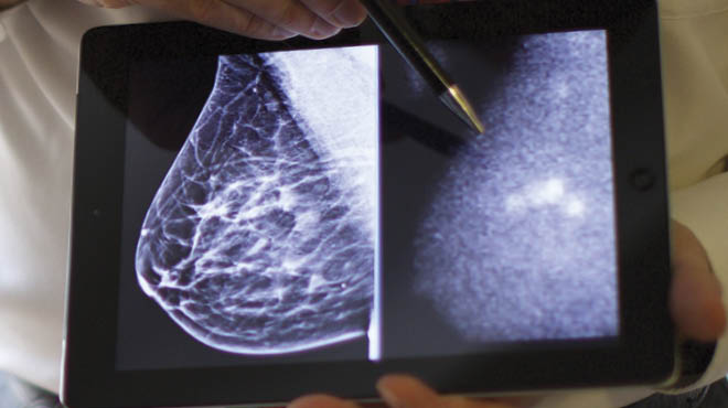 Breast anatomy: fibroglandular and fat tissues, which have