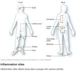 Inlamation Sites